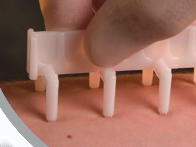 Alergia e Imunologia Clínica